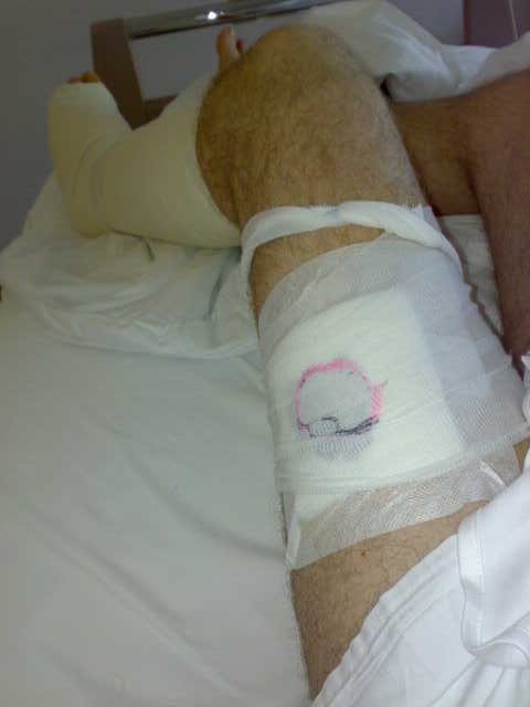 46 greffe du pied